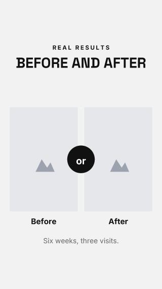 Before and after: story template